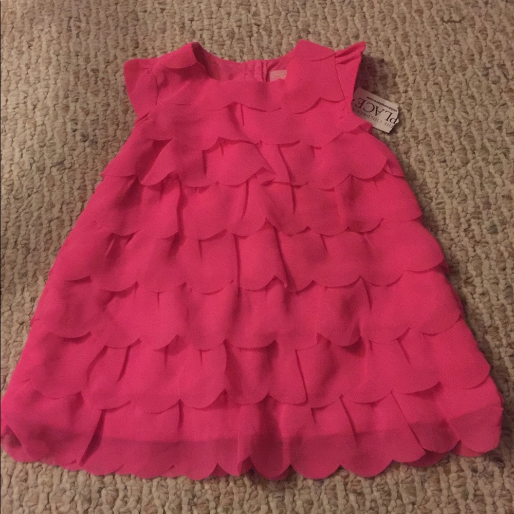 baby dress